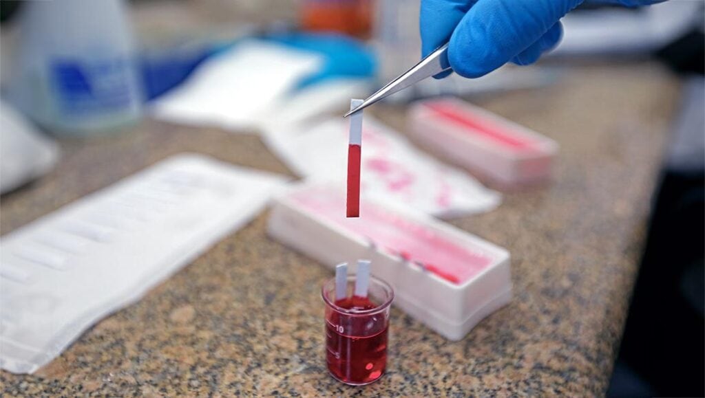 Mão enluvada segura uma tira de teste sobre um recipiente com líquido vermelho, em uma bancada de laboratório.